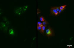 Invitrogen Chromogranin C Recombinant Rabbit Monoclonal Antibody (HL2992)