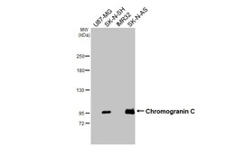 Invitrogen Chromogranin C Recombinant Rabbit Monoclonal Antibody (HL2992)