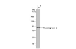 Invitrogen Chromogranin C Recombinant Rabbit Monoclonal Antibody (HL2992)