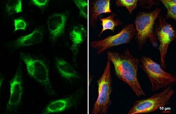 Invitrogen CKAP4 Recombinant Rabbit Monoclonal Antibody (HL2562) 100 &mu;L;