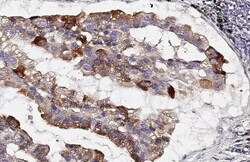 Invitrogen CKAP4 Recombinant Rabbit Monoclonal Antibody (HL2562) 100 &mu;L;