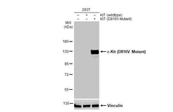 Invitrogen c-Kit (D816V Mutant) Recombinant Rabbit Monoclonal Antibody (HL2653) 100 &mu;L | Buy Online | Invitrogen&trade; | Fisher Scientific