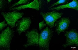 Invitrogen CNOT8 Recombinant Rabbit Monoclonal Antibody (HL2586) 100 &mu;L;