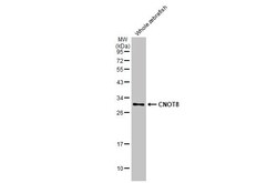 Invitrogen CNOT8 Recombinant Rabbit Monoclonal Antibody (HL2586) 100 &mu;L;
