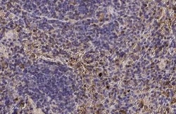Invitrogen CTLA-4 Recombinant Rabbit Monoclonal Antibody (HL2732) 100 &mu;L;