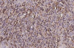 Invitrogen CTLA-4 Recombinant Rabbit Monoclonal Antibody (HL2732) 100 &mu;L;