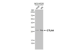 Invitrogen CTLA-4 Recombinant Rabbit Monoclonal Antibody (HL2732) 100 &mu;L;
