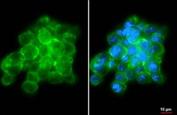 Invitrogen CXCR2 Recombinant Rabbit Monoclonal Antibody (HL2604) 100 &mu;L;