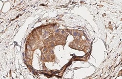 Invitrogen CXCR3 Recombinant Rabbit Monoclonal Antibody (HL3089) 100 &mu;L;