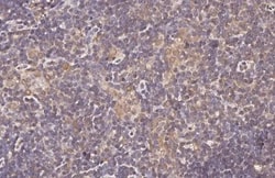 Invitrogen CXCR3 Recombinant Rabbit Monoclonal Antibody (HL3089) 100 &mu;L;