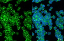 Invitrogen CXCR4 Recombinant Rabbit Monoclonal Antibody (HL2612) 100 &mu;L;