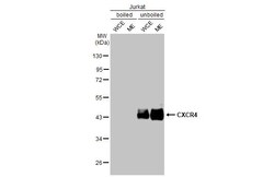 Invitrogen CXCR4 Recombinant Rabbit Monoclonal Antibody (HL2612) 100 &mu;L;