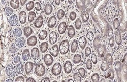Invitrogen Cyclin D1 Recombinant Rabbit Monoclonal Antibody (HL2219) 100