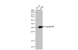 Invitrogen Cyclin D1 Recombinant Rabbit Monoclonal Antibody (HL2219) 100