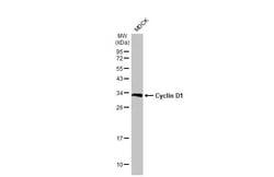 Invitrogen Cyclin D1 Recombinant Rabbit Monoclonal Antibody (HL2219) 100