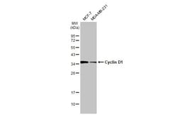 Invitrogen Cyclin D1 Recombinant Rabbit Monoclonal Antibody (HL2219) 100