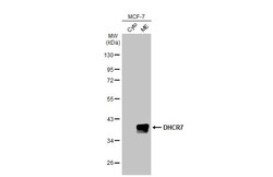 Invitrogen DHCR7 Recombinant Rabbit Monoclonal Antibody (HL2764) 100 &mu;L;