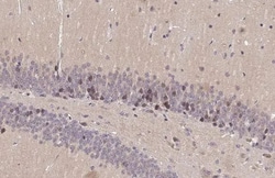 Invitrogen DRD1 Recombinant Rabbit Monoclonal Antibody (HL2680) 100 &mu;L;