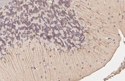 Invitrogen DRD5 Recombinant Rabbit Monoclonal Antibody (HL3081) 100 &mu;L;