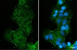 Invitrogen E-cadherin Recombinant Rabbit Monoclonal Antibody (HL1229) 100