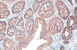 Invitrogen E-cadherin Recombinant Rabbit Monoclonal Antibody (HL1229) 100