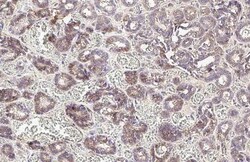 Invitrogen E-cadherin Recombinant Rabbit Monoclonal Antibody (HL1229) 100