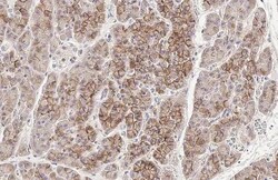 Invitrogen E-cadherin Recombinant Rabbit Monoclonal Antibody (HL1229) 100