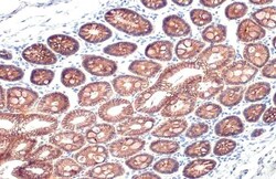 Invitrogen E-cadherin Recombinant Rabbit Monoclonal Antibody (HL1229) 100