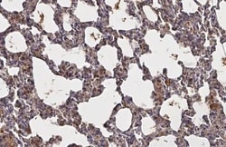 Invitrogen Endothelin B Receptor Recombinant Rabbit Monoclonal Antibody