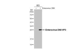 Invitrogen Enterovirus D68 VP3 (Strain: 37-99) Recombinant Rabbit Monoclonal