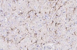 Invitrogen EphA3 Recombinant Rabbit Monoclonal Antibody (HL2651) 100 &mu;L;