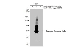 Invitrogen Estrogen Receptor alpha Recombinant Rabbit Monoclonal Antibody