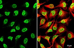 Invitrogen EWSR1 Recombinant Rabbit Monoclonal Antibody (HL3150) 100 &mu;L;