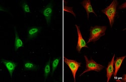 Invitrogen BRIP1 Recombinant Rabbit Monoclonal Antibody (HL2961) 100 &mu;L;