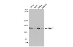 Invitrogen BRIP1 Recombinant Rabbit Monoclonal Antibody (HL2961) 100 &mu;L;
