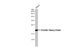 Invitrogen Ferritin Heavy Chain Recombinant Rabbit Monoclonal Antibody