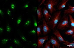 Invitrogen Fibrillarin/FBLL1 Recombinant Rabbit Monoclonal Antibody (HL2588)