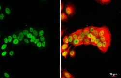 Invitrogen FOXA1 Recombinant Rabbit Monoclonal Antibody (HL3168) 100 &mu;L;