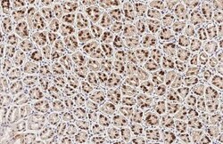 Invitrogen FOXA1 Recombinant Rabbit Monoclonal Antibody (HL3168) 100 &mu;L;