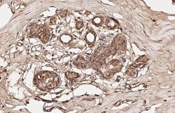 Invitrogen Phospho-FOXO1 (Ser256) Recombinant Rabbit Monoclonal Antibody