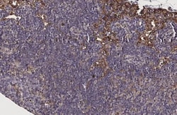 Invitrogen FPR2 Recombinant Rabbit Monoclonal Antibody (HL2664) 100 &mu;L;