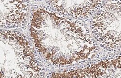 Invitrogen FSHR Recombinant Rabbit Monoclonal Antibody (HL2926) 100 &mu;L;