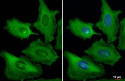 Invitrogen Galectin 3 Recombinant Rabbit Monoclonal Antibody (HL2020) 100 &mu;L | Buy Online | Invitrogen&trade; | Fisher Scientific