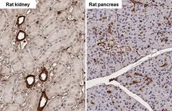 Invitrogen Galectin 3 Recombinant Rabbit Monoclonal Antibody (HL2396) 100