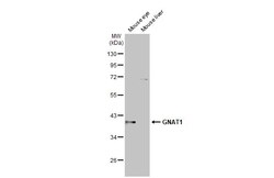 Invitrogen GNAT1 Recombinant Rabbit Monoclonal Antibody (HL2126) 100 &mu;L;