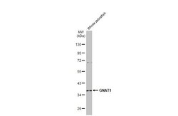 Invitrogen GNAT1 Recombinant Rabbit Monoclonal Antibody (HL2126) 100 &mu;L;