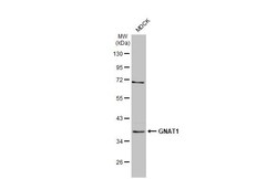 Invitrogen GNAT1 Recombinant Rabbit Monoclonal Antibody (HL2126) 100 &mu;L;