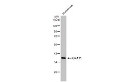 Invitrogen GNAT1 Recombinant Rabbit Monoclonal Antibody (HL2126) 100 &mu;L;