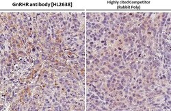 Invitrogen GnRHR Recombinant Rabbit Monoclonal Antibody (HL2638) 100 &mu;L;