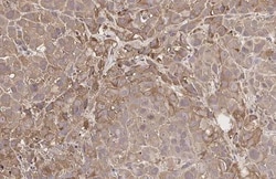 Invitrogen GnRHR Recombinant Rabbit Monoclonal Antibody (HL2638) 100 &mu;L;